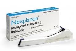 nexplanon